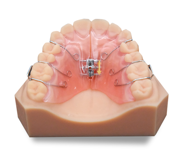 pós-processamento de impressão 3D em resina com limpeza e cura UV