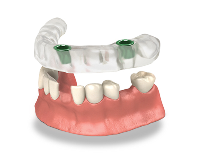 revisão de informações técnicas para página editorial da YDM 3D