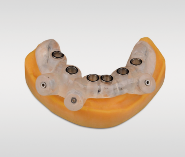 modelos dentários impressos em resina para fluxo odontológico digital